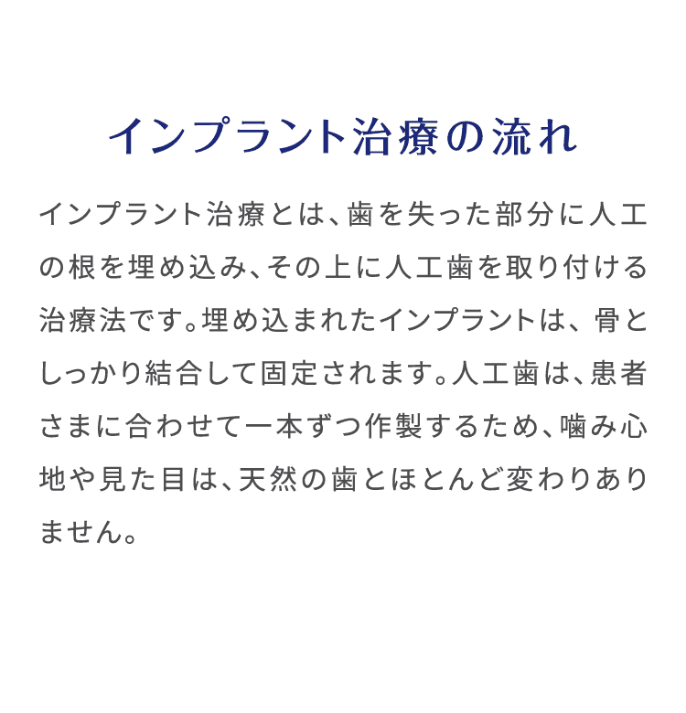 インプラント治療の流れ